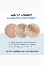 Centella Hyalu-Cica Blue Serum, 50ml