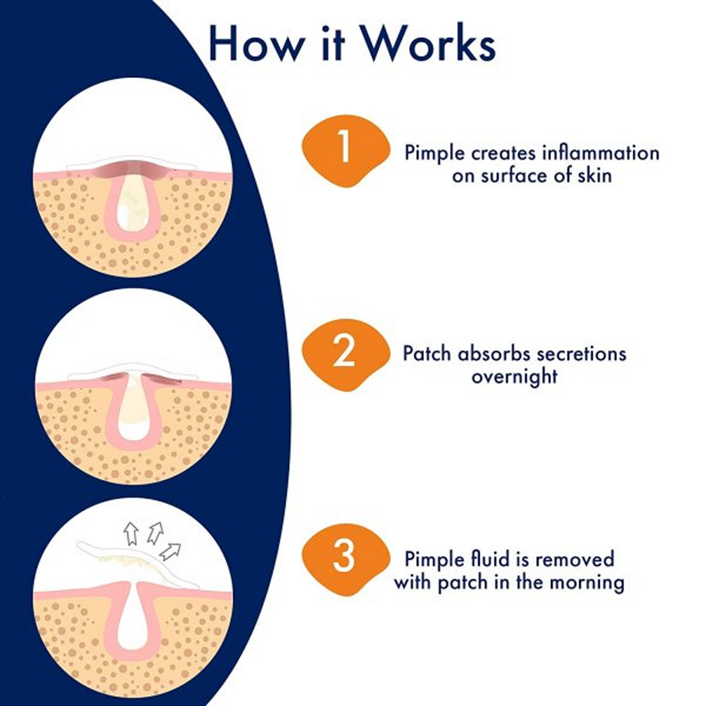 PANOXYL OVERNIGHT SPOT PATCHES 40 PATCHES