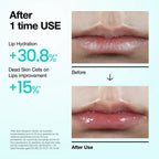 Anua PDRN Lip Serum – 10ml