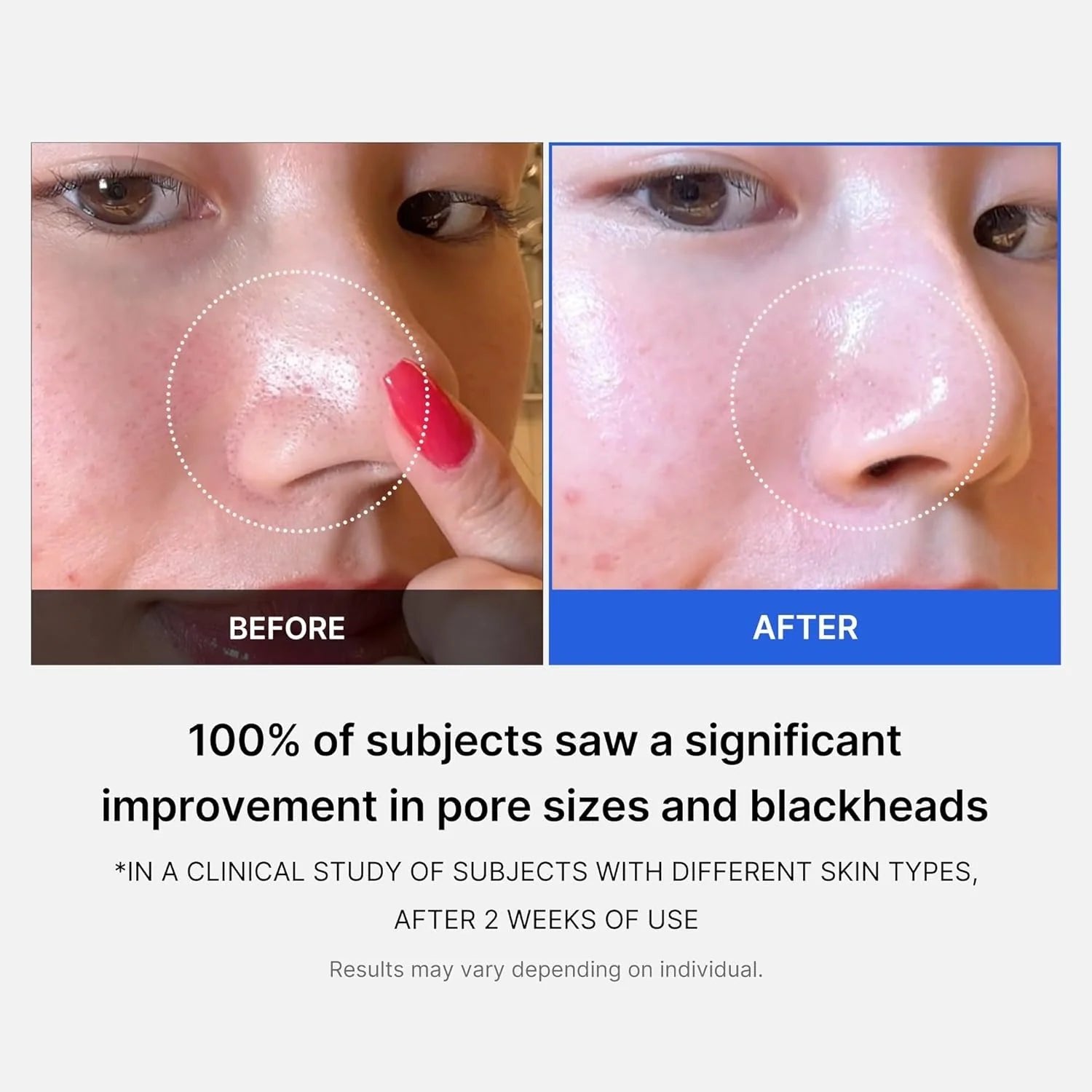 Medicube Zero Pore Pad - 155g (70 Pads)
