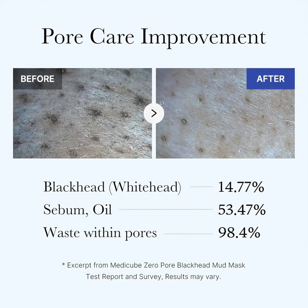 Centella Zero Pore Blackhead Mud Mask - 100g