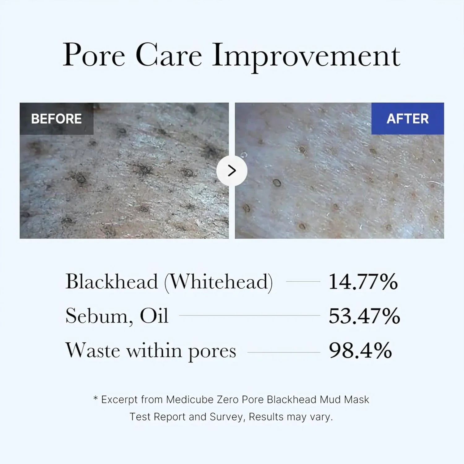 Centella Zero Pore Blackhead Mud Mask - 100g